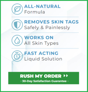 Bliss-Skin-Tag-Remover